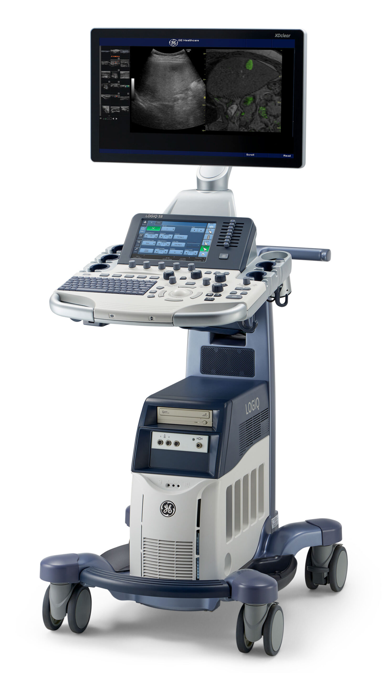 Ge-Logiq-S8-14-Ultrasound-molu-diagnostics